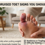 Broken or Bruised Toe? Signs You Shouldn’t Ignore